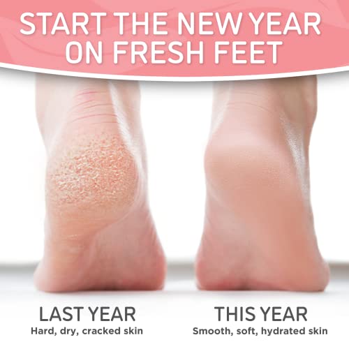 Soft Touch Foot Peel Mask - Pack of 2 Feet Peeling Masks for Dry, Cracked Heels & Calluses - Exfoliating Foot Mask Peel for Baby Soft Skin, Original Aloe Vera